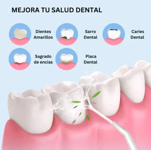 Irrigador Bucal Limpieza Profunda - CleanTeeth™